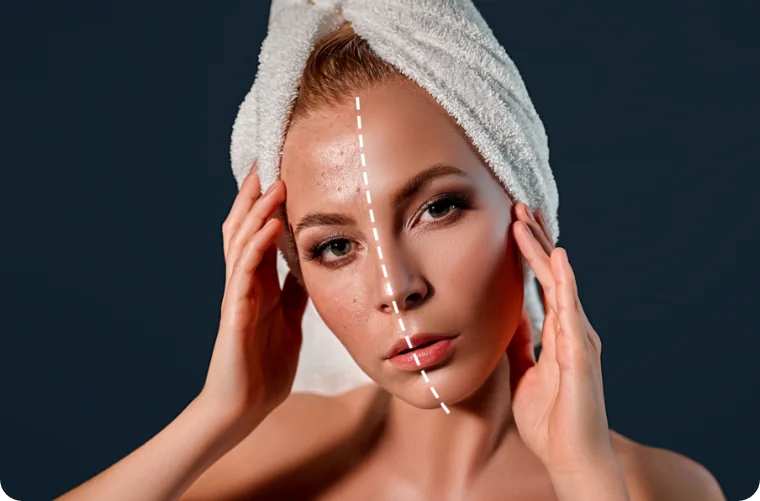 A model with a towel on her head: the left side of her face shows the original skin, the right side after natural retouching